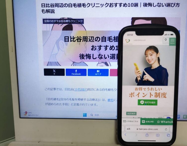 日比谷周辺の自毛植毛クリニックおすすめ10選｜後悔しない選び方も解説