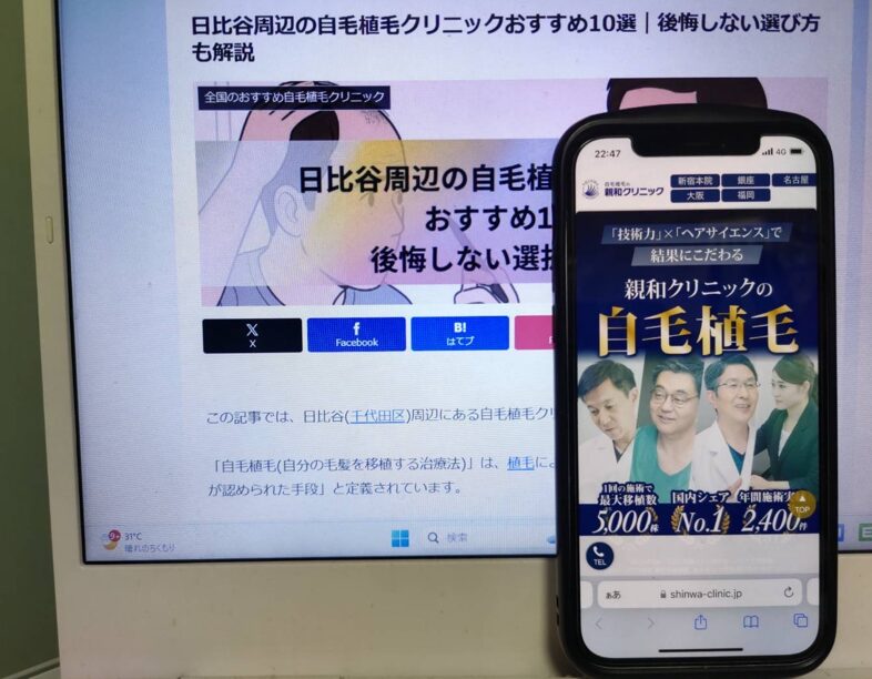 日比谷周辺の自毛植毛クリニックおすすめ10選｜後悔しない選び方も解説