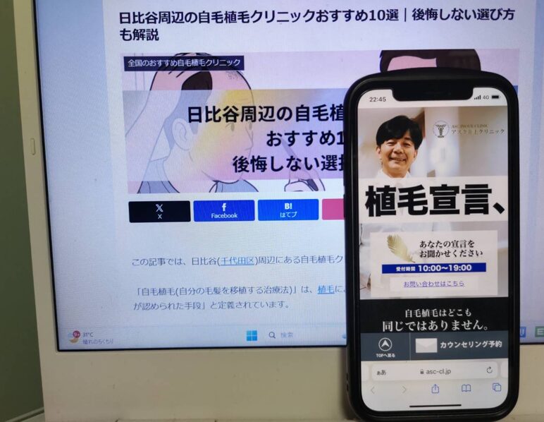 日比谷周辺の自毛植毛クリニックおすすめ10選｜後悔しない選び方も解説