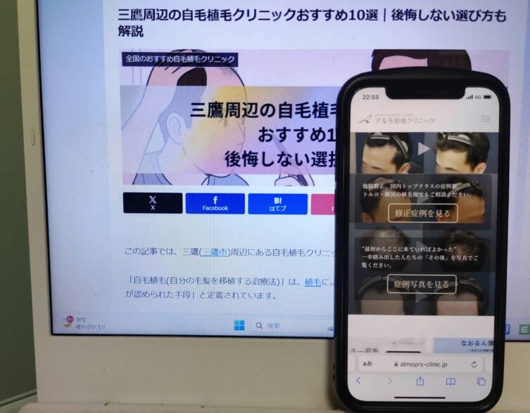 三鷹周辺の自毛植毛クリニックおすすめ10選｜後悔しない選び方も解説