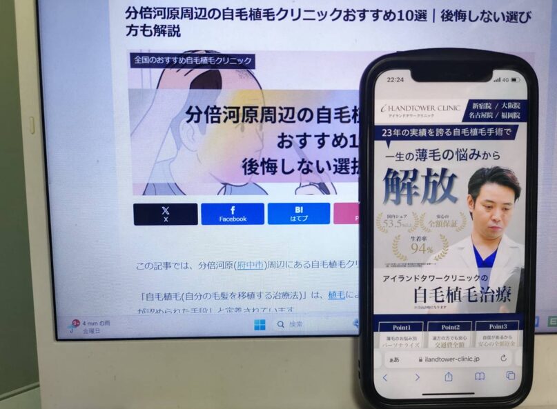 分倍河原周辺の自毛植毛クリニックおすすめ10選｜後悔しない選び方も解説