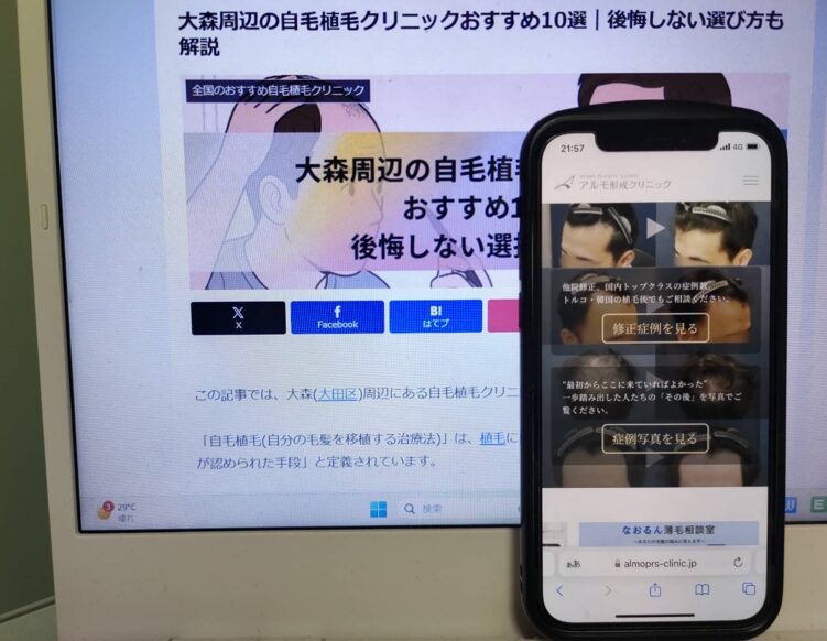 大森周辺の自毛植毛クリニックおすすめ10選｜後悔しない選び方も解説