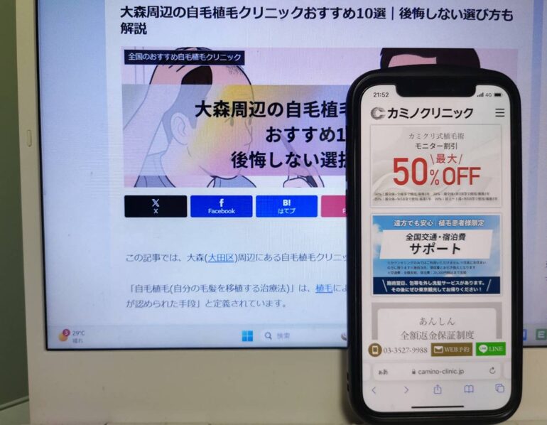大森周辺の自毛植毛クリニックおすすめ10選｜後悔しない選び方も解説