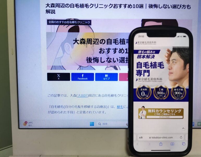 大森周辺の自毛植毛クリニックおすすめ10選｜後悔しない選び方も解説