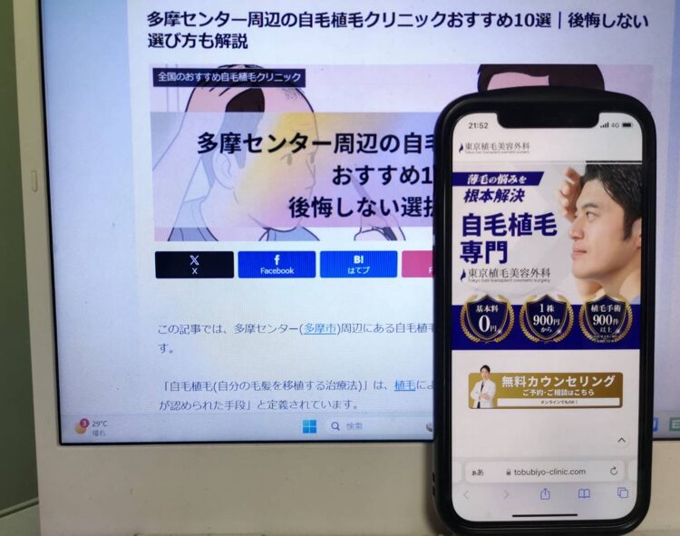 多摩センター周辺の自毛植毛クリニックおすすめ10選｜後悔しない選び方も解説