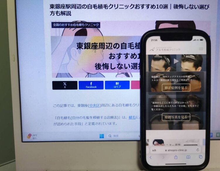 東銀座周辺の自毛植毛クリニックおすすめ10選｜後悔しない選び方も解説
