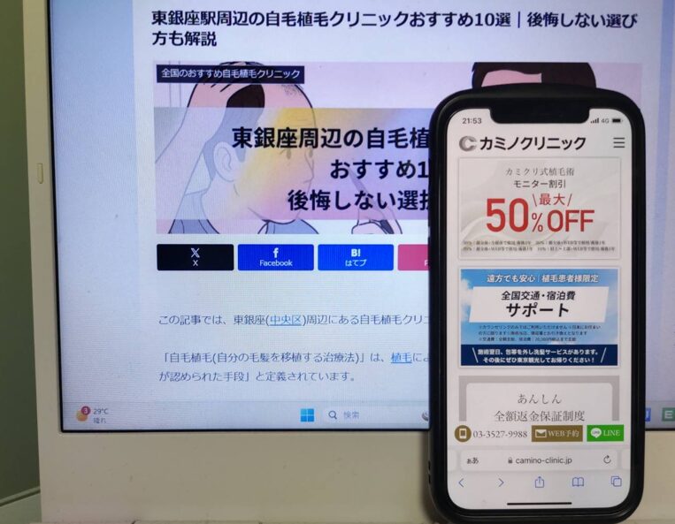 東銀座周辺の自毛植毛クリニックおすすめ10選｜後悔しない選び方も解説