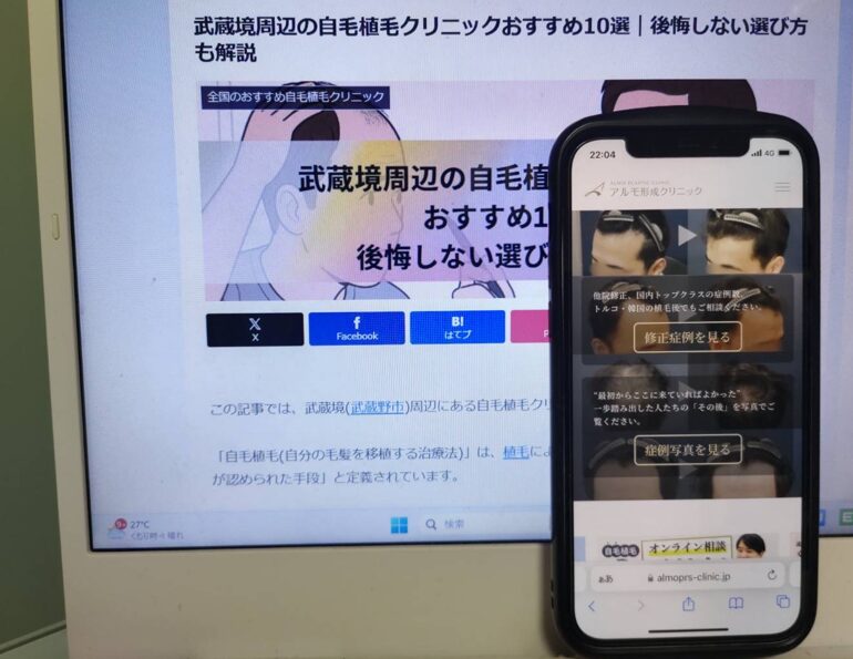 武蔵境周辺の自毛植毛クリニックおすすめ10選｜後悔しない選び方も解説