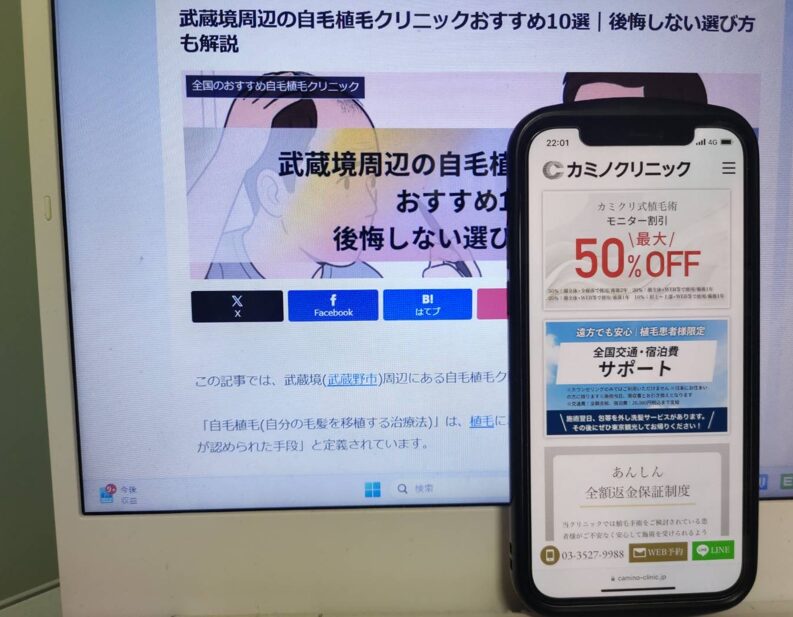 武蔵境周辺の自毛植毛クリニックおすすめ10選｜後悔しない選び方も解説