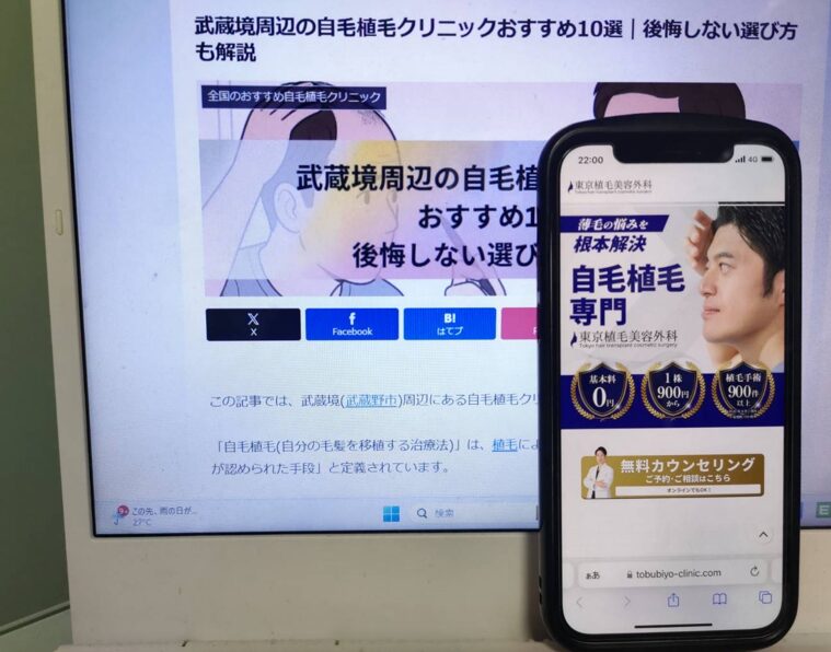 武蔵境周辺の自毛植毛クリニックおすすめ10選｜後悔しない選び方も解説