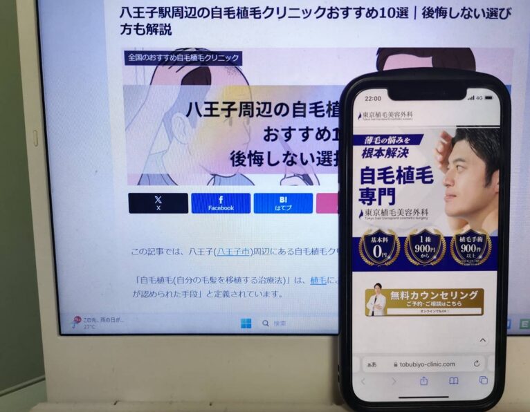 八王子駅周辺の自毛植毛クリニックおすすめ10選｜後悔しない選び方も解説