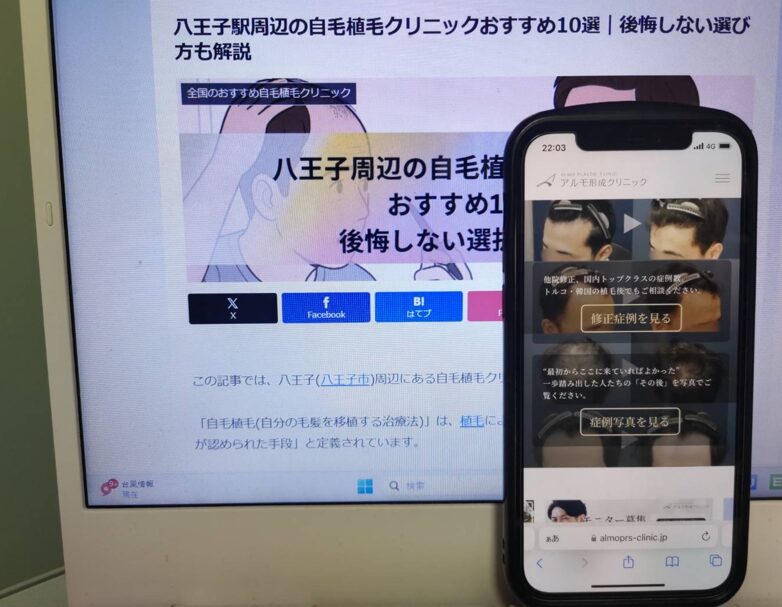 八王子駅周辺の自毛植毛クリニックおすすめ10選｜後悔しない選び方も解説