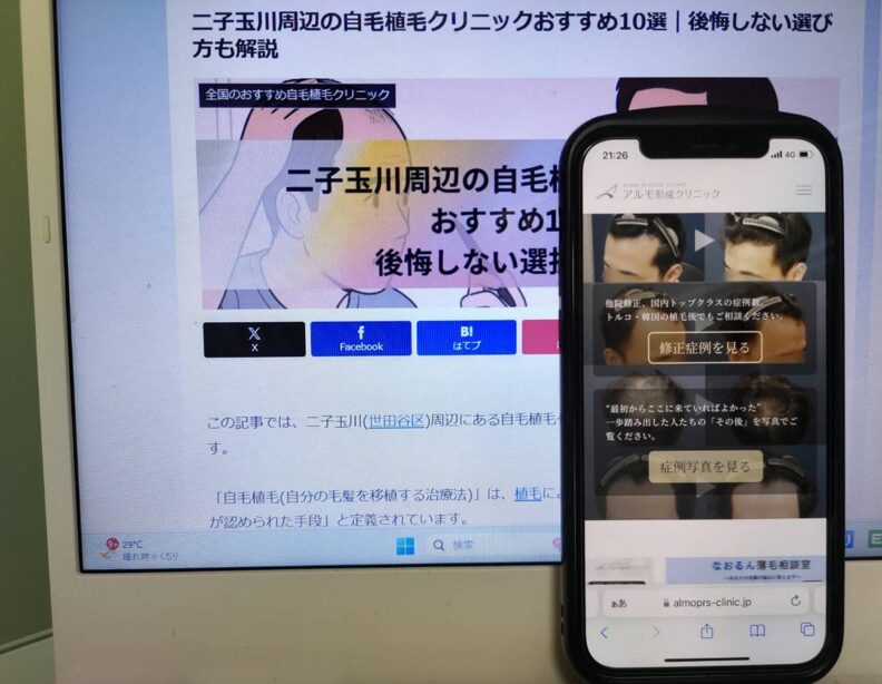 二子玉川周辺の自毛植毛クリニックおすすめ10選｜後悔しない選び方も解説
