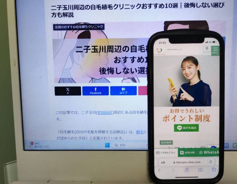 二子玉川周辺の自毛植毛クリニックおすすめ10選｜後悔しない選び方も解説