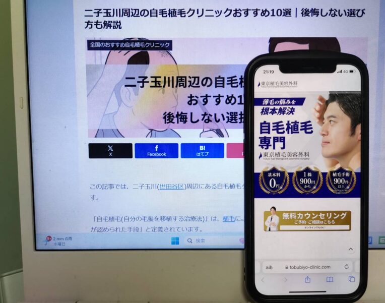 二子玉川周辺の自毛植毛クリニックおすすめ10選｜後悔しない選び方も解説