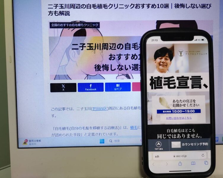 二子玉川周辺の自毛植毛クリニックおすすめ10選｜後悔しない選び方も解説