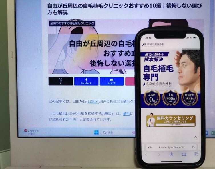 自由が丘周辺の自毛植毛クリニックおすすめ10選｜後悔しない選び方も解説