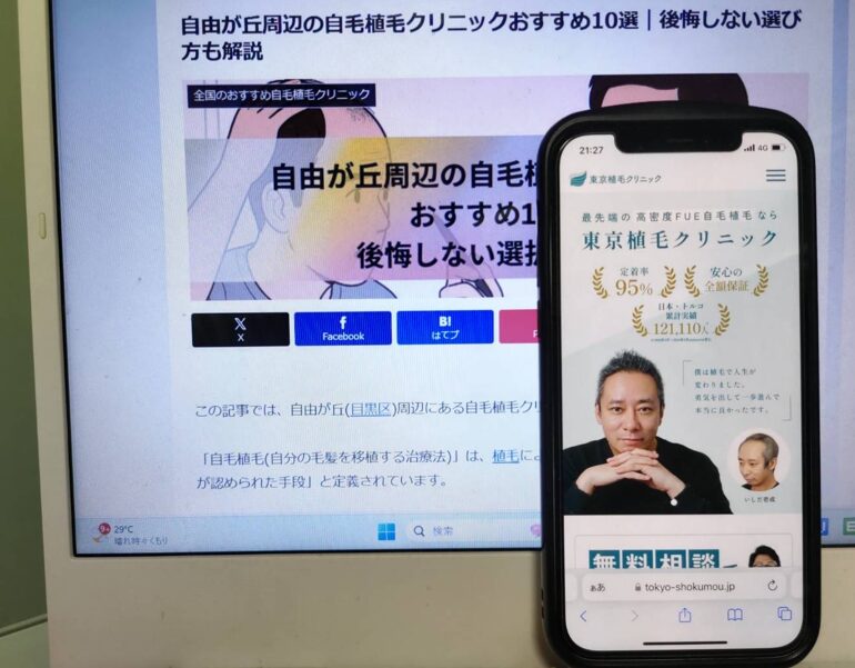自由が丘周辺の自毛植毛クリニックおすすめ10選｜後悔しない選び方も解説