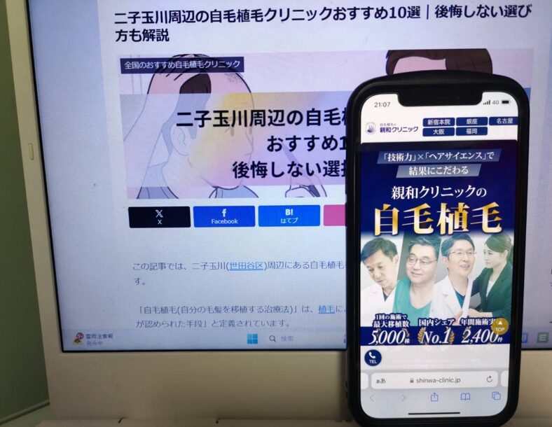 二子玉川周辺の自毛植毛クリニックおすすめ10選｜後悔しない選び方も解説
