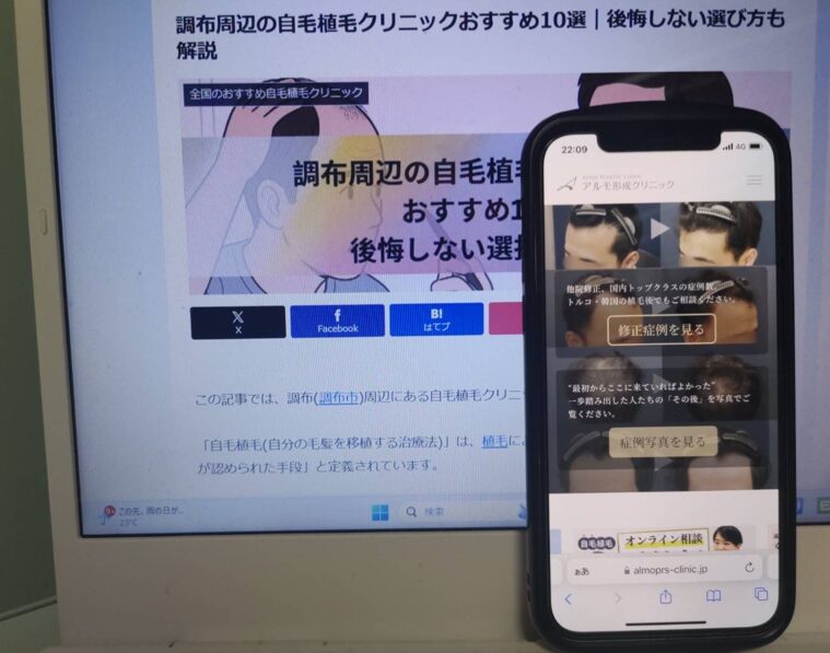 調布周辺の自毛植毛クリニックおすすめ10選｜後悔しない選び方も解説