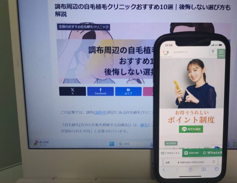 調布周辺の自毛植毛クリニックおすすめ10選｜後悔しない選び方も解説