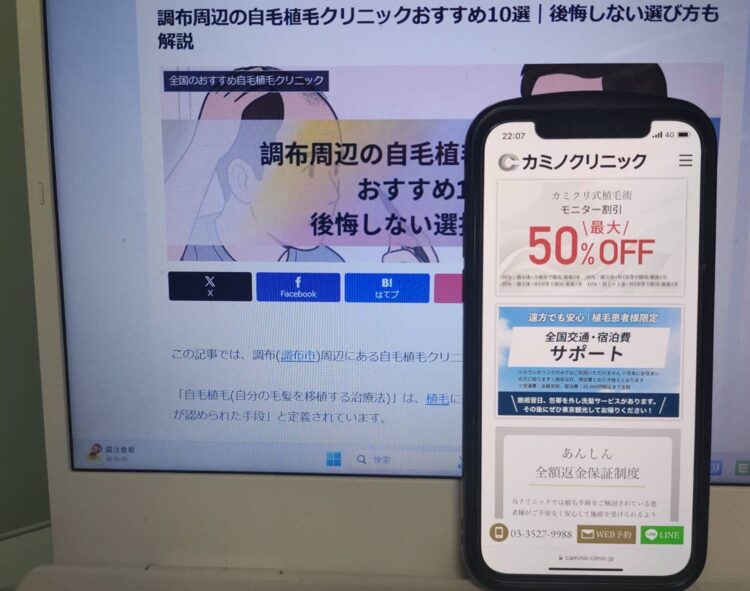 調布周辺の自毛植毛クリニックおすすめ10選｜後悔しない選び方も解説