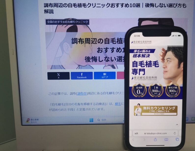 調布周辺の自毛植毛クリニックおすすめ10選｜後悔しない選び方も解説