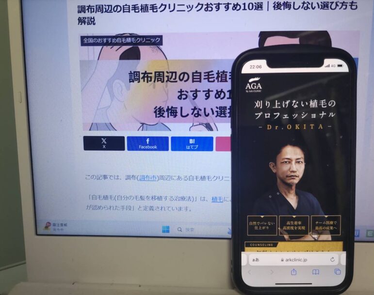 調布周辺の自毛植毛クリニックおすすめ10選｜後悔しない選び方も解説