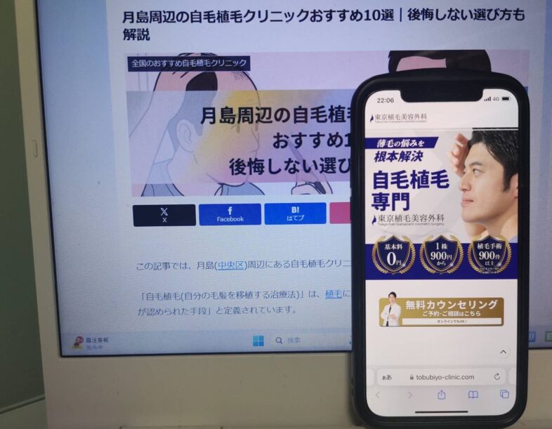 月島周辺の自毛植毛クリニックおすすめ10選｜後悔しない選び方も解説