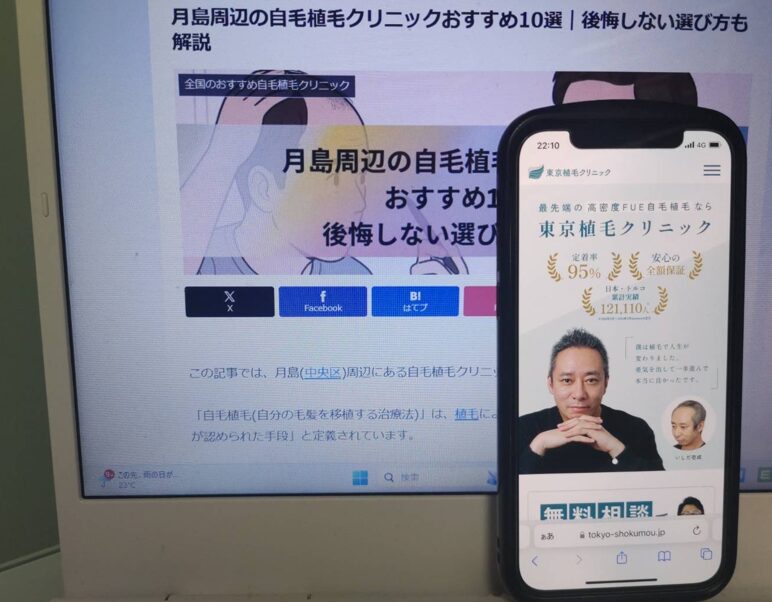 月島周辺の自毛植毛クリニックおすすめ10選｜後悔しない選び方も解説